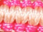 Raspberry